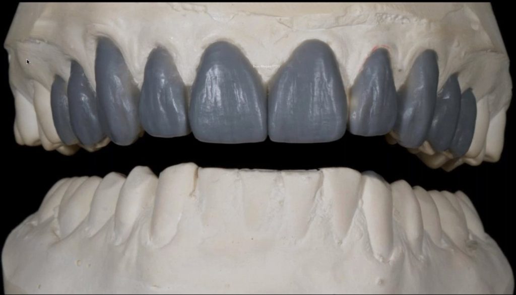 The Four Goals of Biomimetic Dentistry | Part 1 of 4