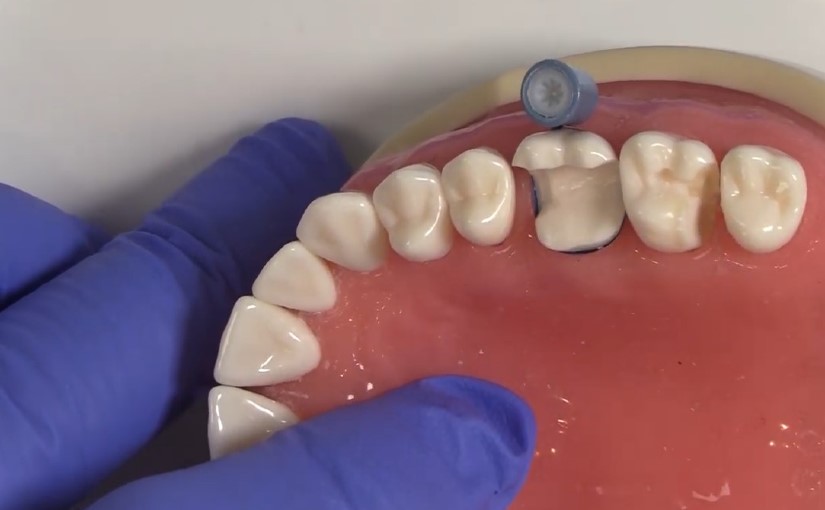 Margin Elevation Technique Demystified with Dr Matt Nejad Dental