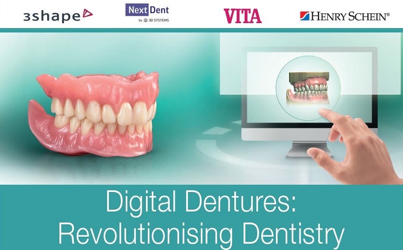 Digital Dentures: Revolutionising Dentistry